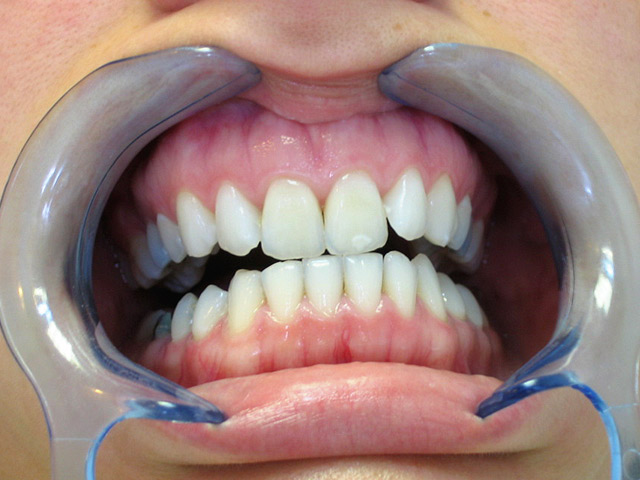 Bez�r�shoz kattintson a k�pre!