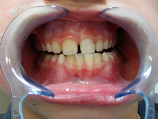 Bez�r�shoz kattintson a k�pre!