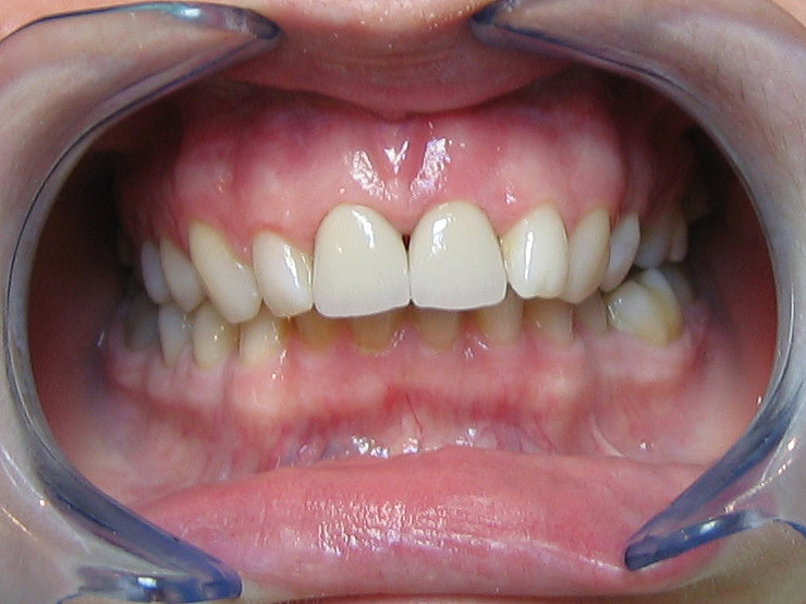 Bez�r�shoz kattintson a k�pre!